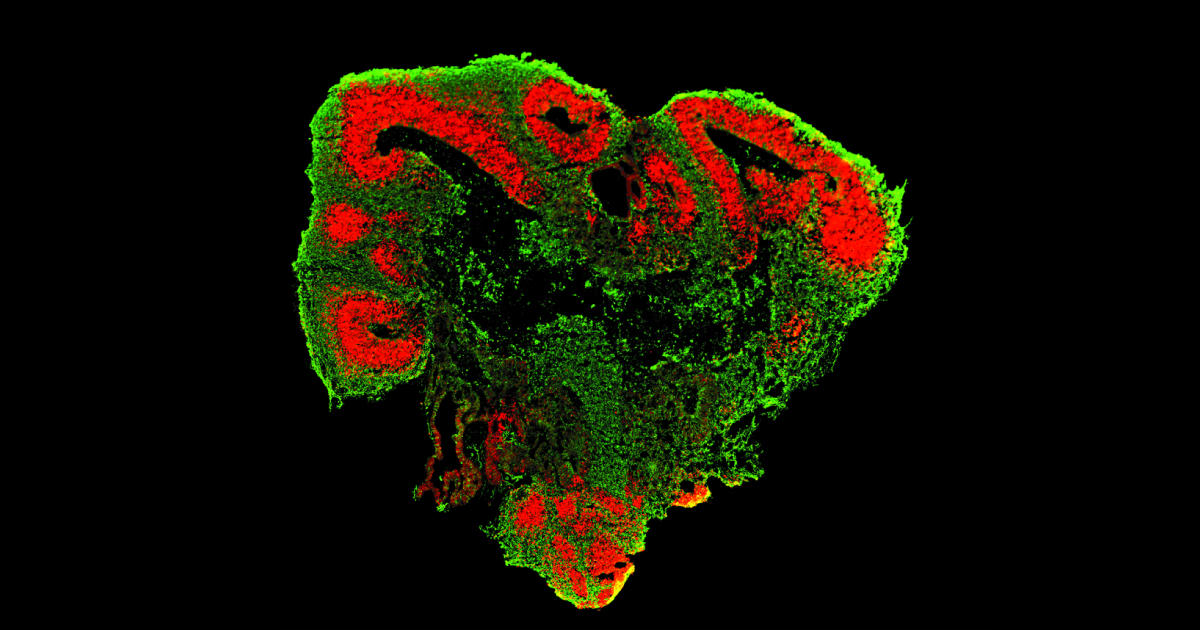 ヒト多能性幹細胞から「ミニ大脳」への分化・成熟培地