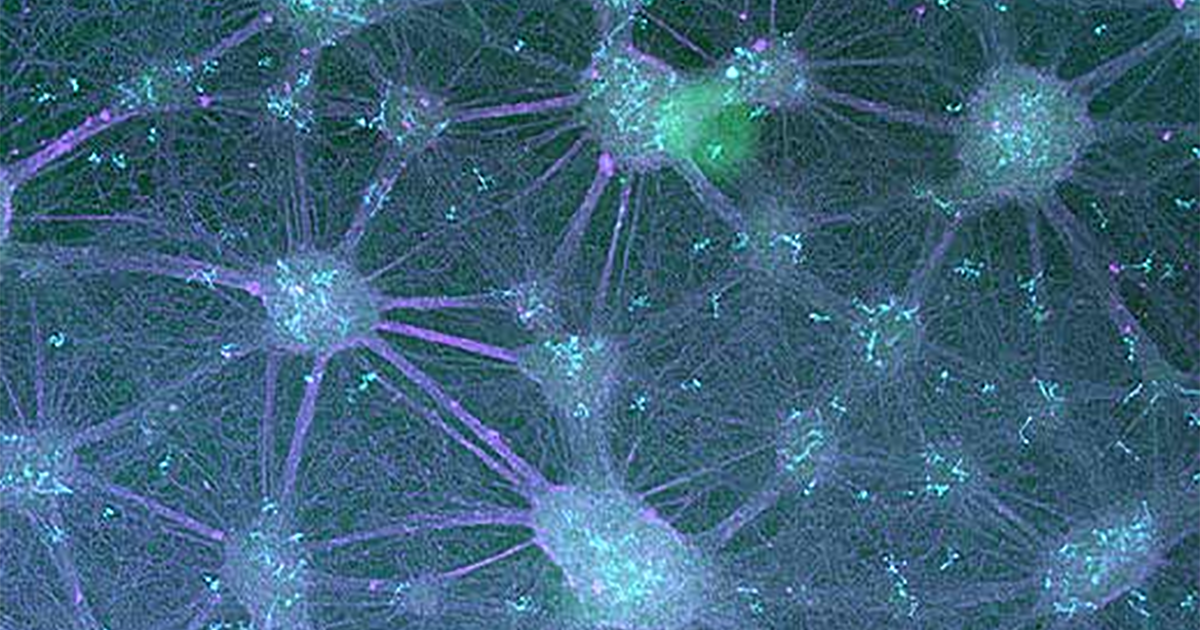 ミクログリア、アストロサイト、前脳ニューロンの共培養プロトコル