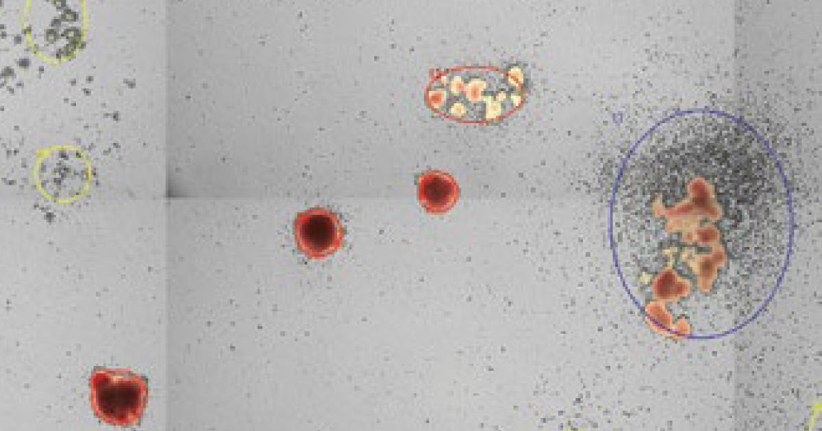 「STEMvision」　造血前駆細胞CFUアッセイを自動化