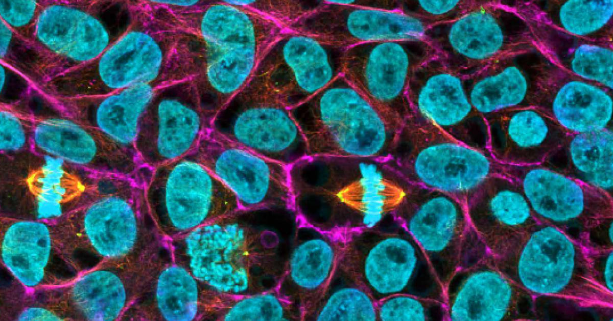 ES/iPS細胞培養におけるシングルセル継代の課題