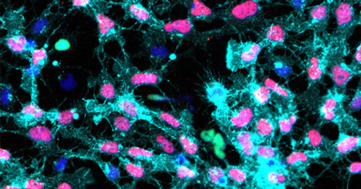 「STEMdiff Neural Crest Differentiation Kit」ヒト多能性幹細胞から神経堤細胞へ効率的に誘導